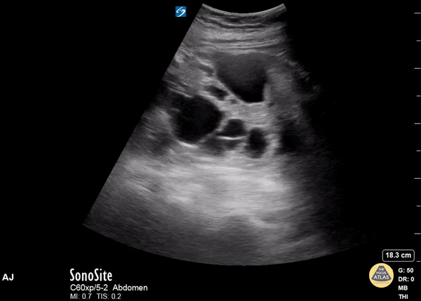 健康・医学 ATLAS OF Renal Ultrasonography O'NEILL Renal ultrasonography - Wikipedia